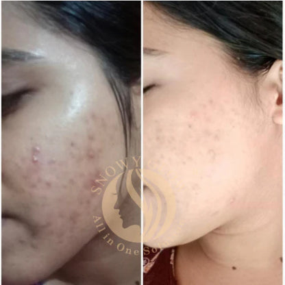 Night Repair Brightening Cream Regular (Effects within 1 Week)