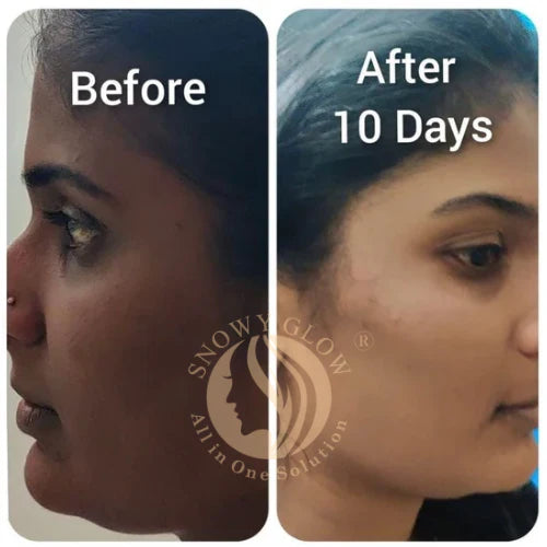 Night Repair Brightening Cream Regular (Effects within 1 Week)