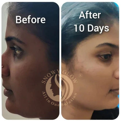 Night Repair Brightening Cream Regular (Effects within 1 Week)